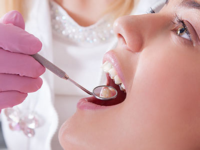 Granger Dentistry | Dental Sealants, Dental Lab and Dentures